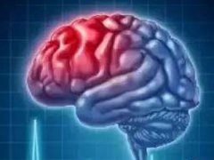 又到脑卒中高发季 你的颈动脉还好吗？